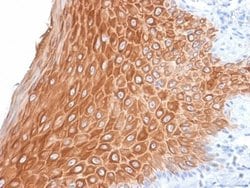 Cytokeratin 16 Antibody (KRT16/2043R) - Azide and BSA Free, Novus Biologicals